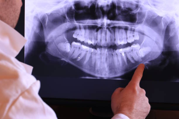 Best Emergency Dentist for Lost Fillings or Crowns in Fayetteville, PA