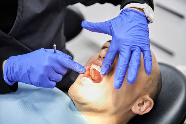 Best Emergency Dentist for Knocked-Out Tooth in Fayetteville, PA